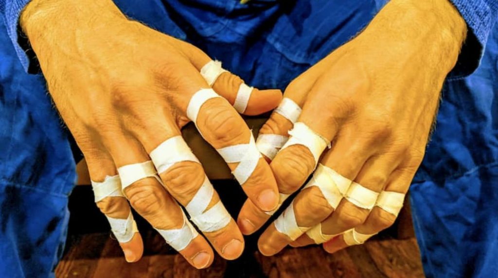 Common BJJ Injuries Prevention & Treatment Guide